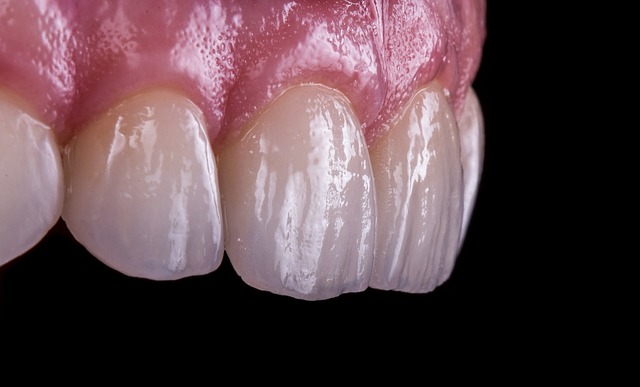Detail pohledu na zuby